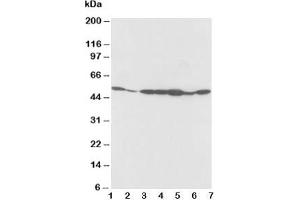 Western blot testing of alpha 2a Adrenergic Receptor antibody and Lane 1:  rat testis;  2: rat brain;  3: MCF-7;  4: MM453;  5: SMMC-7721;  6: HeLa;  7: COLO320 cell lysate (ADRA2A antibody  (C-Term))