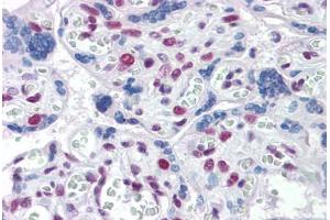 Human Placenta: Formalin-Fixed, Paraffin-Embedded (FFPE) (TOPORS antibody  (AA 98-206))