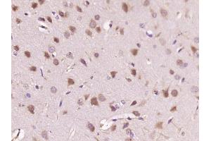 PTPN23 antibody  (AA 1501-1636)