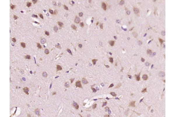 PTPN23 antibody  (AA 1501-1636)