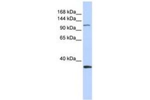 Image no. 1 for anti-Minichromosome Maintenance Complex Component 2 (MCM2) (AA 828-877) antibody (ABIN6742706) (MCM2 antibody  (AA 828-877))