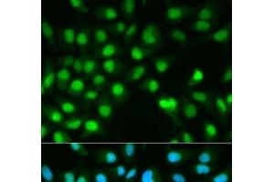 Immunofluorescence analysis of HeLa cells using PPP3CA Polyclonal Antibody (PPP3CA antibody)