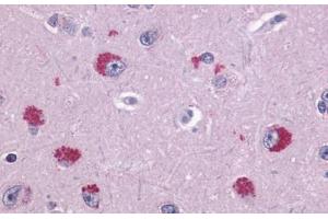 Anti-TAAR1 antibody  ABIN1049378 IHC staining of human brain, neurons. (TAAR1 antibody  (Extracellular Domain))