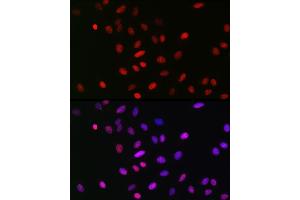 Immunofluorescence analysis of U2OS cells using MonoMethyl-Histone H3-K18 Rabbit mAb (ABIN7267683) at dilution of 1:100 (40x lens). (Histone 3 antibody  (H3K18me))