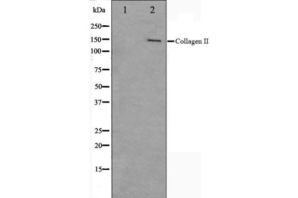 COL2A1 antibody  (N-Term)