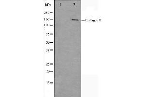Western blot analysis on COLO205 cell lysate using Collagen II Antibody,The lane on the left is treated with the antigen-specific peptide. (COL2A1 antibody  (N-Term))