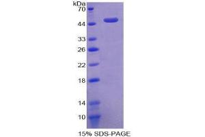SDS-PAGE (SDS) image for Activin Receptor Type I (ACRV1) (AA 208-340) protein (His tag,GST tag) (ABIN2122352)