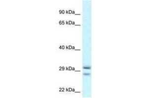Image no. 1 for anti-Ras-Like Without CAAX 1 (RIT1) (AA 108-157) antibody (ABIN6747637) (RIT1 antibody  (AA 108-157))