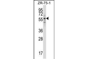 Western blot analysis in ZR-75-1 cell line lysates (35ug/lane). (RPS6KB1 antibody  (C-Term))