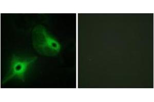 Immunofluorescence analysis of HeLa cells, using KSR2 Antibody. (KSR2 antibody  (AA 671-720))
