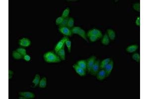 Immunofluorescent analysis of HepG2 cells using ABIN7144131 at dilution of 1:100 and Alexa Fluor 488-congugated AffiniPure Goat Anti-Rabbit IgG(H+L) (AGT antibody  (AA 35-285))