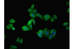 Immunofluorescent analysis of HepG2 cells using ABIN7144131 at dilution of 1:100 and Alexa Fluor 488-congugated AffiniPure Goat Anti-Rabbit IgG(H+L) (AGT antibody  (AA 35-285))