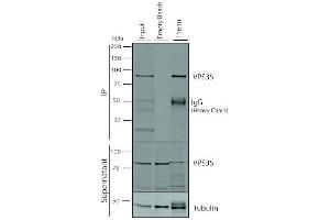 Immunoprecipitation analysis using Mouse Anti-VPS35 Monoclonal Antibody, Clone 11H10 (ABIN6933023).