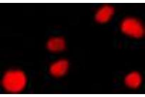 Immunofluorescent analysis of NUP160 staining in NIH3T3 cells. (NUP160 antibody  (Center))