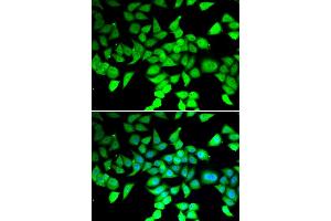 Immunofluorescence analysis of MCF-7 cells using HDAC7 antibody (ABIN5974387). (HDAC7 antibody)