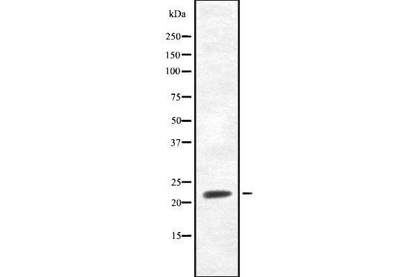FGF20 antibody  (Internal Region)