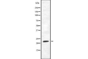 Western blot analysis FGF20 using RAW264. (FGF20 antibody  (Internal Region))
