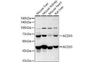 Western blot analysis of extracts of various cell lines, using  antibody (ABIN6131168, ABIN6136442, ABIN6136443 and ABIN6224114) at 1:500 dilution.