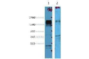 Western Blotting (WB) image for anti-Receptor tyrosine-protein kinase erbB-2 (ErbB2/Her2) antibody (ABIN3188001)