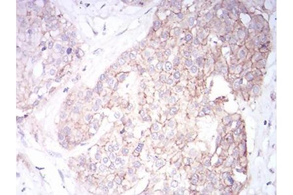 KCNN2 antibody  (AA 36-52)