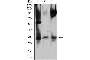 Western blot analysis using CD322 mouse mAb against NIH/3T3 (1), Ramos (2), and HepG2 (3) cell lysate.