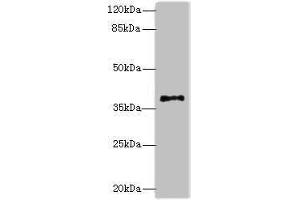 Western blot All lanes: PLCXD1 antibody at 2 μg/mL + Jurkat whole cell lysate Secondary Goat polyclonal to rabbit IgG at 1/10000 dilution Predicted band size: 37 kDa Observed band size: 37 kDa (PLCXD1 antibody  (AA 1-323))