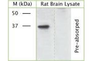 WB on rat brain lysate using Rabbit antibody to phospho S41 of Axonal membrane protein GAP-43 (Neuromodulin, growth-associated protein 43): IgG (ABIN350110) at 50 µg/ml concentration incubated overnight at 4°C. (GAP43 antibody  (pSer41))