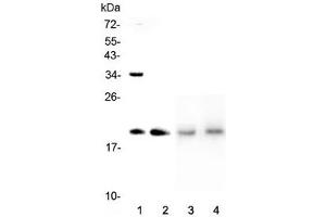 Western blot testing of 1) human HeLa, 2) human placenta, 3) rat lung and 4) mouse lung lysate with Dermatopontin antibody at 0.