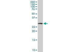 ARPC2 monoclonal antibody (M01), clone 5C8. (ARPC2 antibody  (AA 1-300))