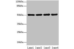 Western blot All lanes: CEACAM1 antibody at 10 μg/mL Lane 1: HT29 whole cell lysate Lane 2: HCT116 whole cell lysate Lane 3: COLO205 whole cell lysate Lane 4: HepG2 whole cell lysate Secondary Goat polyclonal to rabbit IgG at 1/10000 dilution Predicted band size: 58, 46, 36, 39, 51, 47, 28, 44, 52, 40 kDa Observed band size: 51 kDa (CEACAM1 antibody  (AA 35-428))