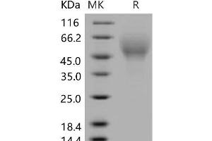 CD200R4 Protein (His tag)