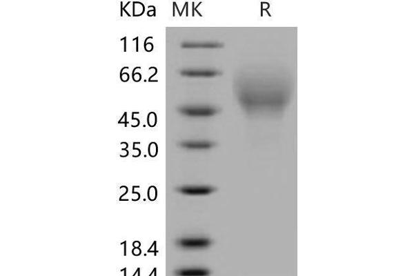 CD200R4 Protein (His tag)