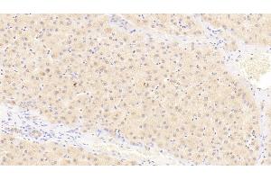 Detection of IL23a in Human Liver Tissue using Polyclonal Antibody to Interleukin 23 Subunit Alpha (IL23a) (IL23A antibody  (AA 20-189))