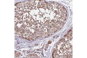 Immunohistochemical staining of human testis with DMXL2 polyclonal antibody  shows moderate cytoplasmic positivity in seminiferous ducts at 1:50-1:200 dilution.