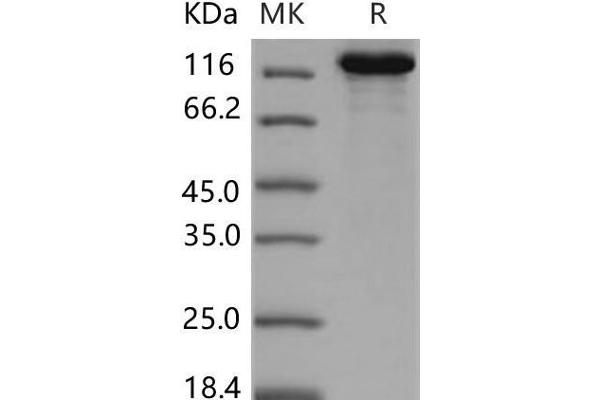 CNTNAP2 Protein (His tag)