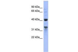 Image no. 1 for anti-Mitochondrial Ribosomal Protein L37 (MRPL37) (AA 35-84) antibody (ABIN6741668) (MRPL37 antibody  (AA 35-84))