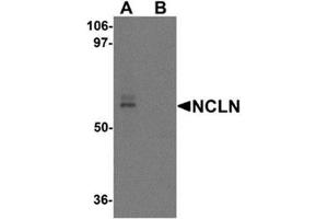 Western blot analysis of NCLN in mouse heart tissue lysate with NCLN antibody at 0. (Nicalin antibody  (C-Term))