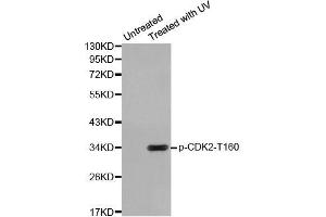 Western blot analysis of extracts from HeLa cells using Phospho-CDK2-T160 antibody (ABIN2987938). (CDK2 antibody  (pThr160))