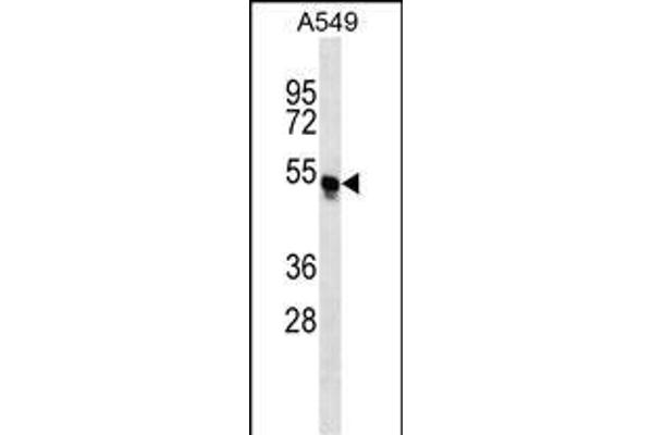 TRIM54 Antikörper  (N-Term)
