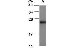 WB Image Sample(30 μg of whole cell lysate) A:MOLT4, 15% SDS PAGE antibody diluted at 1:500 (SRI antibody)