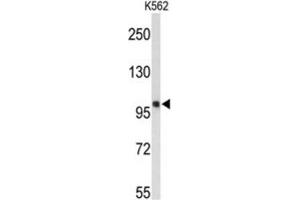 Western Blotting (WB) image for anti-Heat Shock 105kDa/110kDa Protein 1 (HSPH1) antibody (ABIN3001677) (HSPH1 antibody)