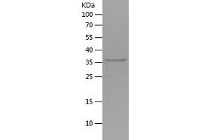 Western Blotting (WB) image for C-Type Lectin Domain Family 9, Member A (CLEC9A) (AA 100-209) protein (His tag) (ABIN7282341) (CLEC9A Protein (AA 100-209) (His tag))