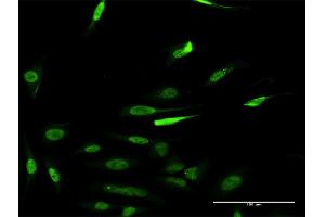 Immunofluorescence (IF) image for anti-Regulator of Chromosome Condensation 1 (RCC1) (AA 312-421) antibody (ABIN514370)