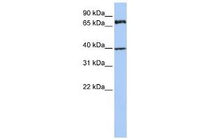 Western Blotting (WB) image for anti-Membrane Protein, Palmitoylated 5 (MAGUK P55 Subfamily Member 5) (MPP5) antibody (ABIN2458687) (MPP5 antibody)