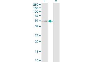 Western Blot analysis of MPND expression in transfected 293T cell line by FLJ14981 monoclonal antibody (M01), clone 1C12. (MPND antibody  (AA 84-181))
