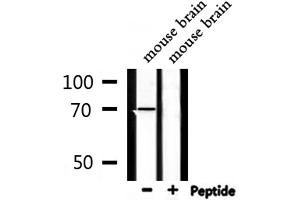 Western blot analysis of extracts from mouse brain, using DYR1B Antibody. (DYRK1B antibody  (Internal Region))