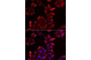 Immunofluorescence analysis of U2OS cells using PDLIM1 antibody (ABIN5974031). (PDLIM1 antibody)