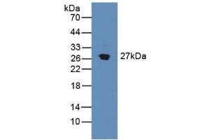 Detection of SDF4 in Mouse Pancreas Tissue using Polyclonal Antibody to Stromal Cell Derived Factor 4 (SDF4) (SDF4 antibody  (AA 184-382))