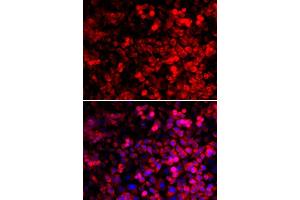 Immunofluorescence analysis of U2OS cells using QARS antibody. (QARS antibody  (AA 1-250))