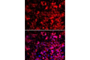 Immunofluorescence analysis of U2OS cells using QARS antibody. (QARS antibody  (AA 1-250))